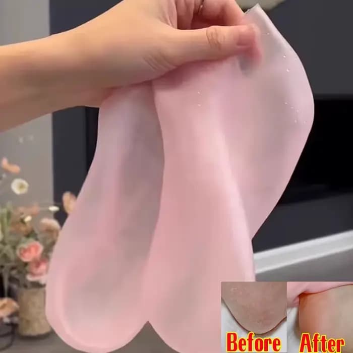 1 paire de chaussettes de soin des pieds en Silicone