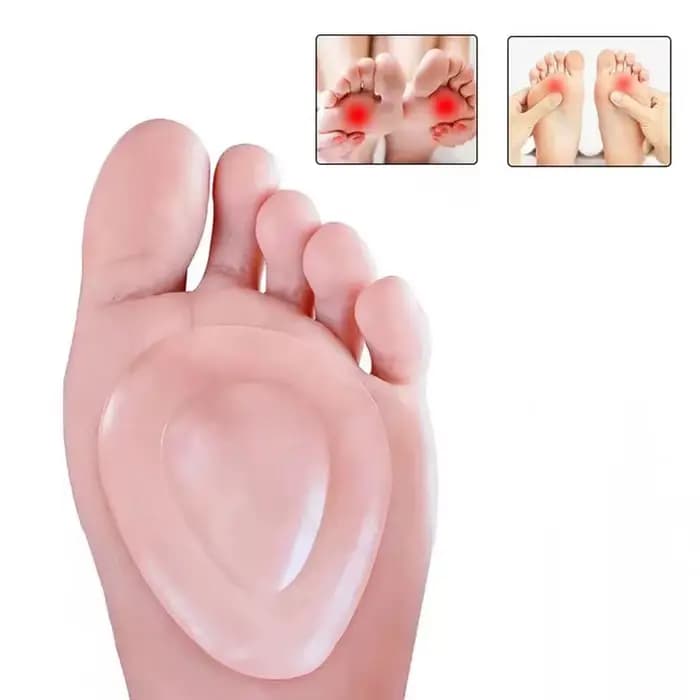 1 paire de coussinets pour l'avant-pied, soulage la douleur, semelles orthopédiques en Silicone, Ant