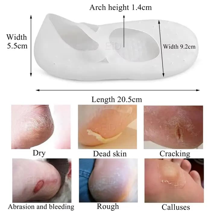 EiD – chaussettes en Gel de Silicone pour les pieds, soins anti-gerçures, anti-douleur, anti-fissure, hydratant, élimine la peau morte, avec trou
