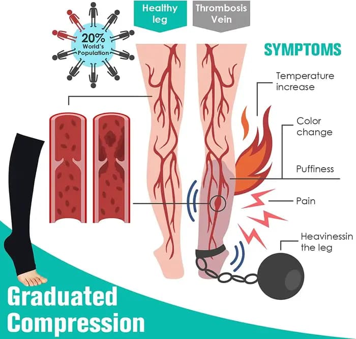 Chaussettes de Compression S-XXL médicales pour prévenir les varices