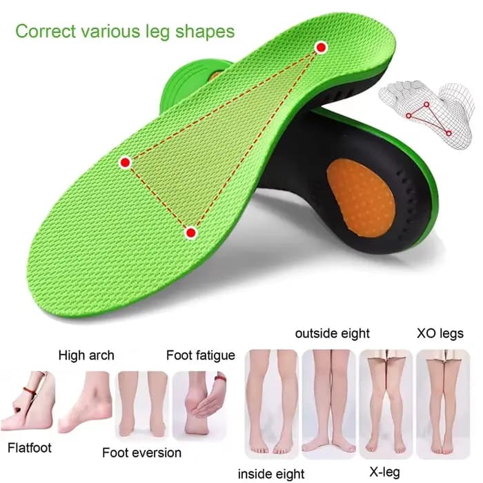 Semelles Orthopédiques Support de Voûte Plantaire de Sport Semelles Orthopédiques de Pied Plat pour Chaussures Femmes Hommes Coussinet de Pied de Voûte Plantaire X / O Coussinets de Correction de Jamb