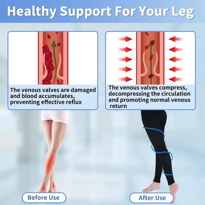 Collants de Compression médicaux 22-32mmHg collants de Compression de soutien gradué Leggings sans pieds pour œdème, varices